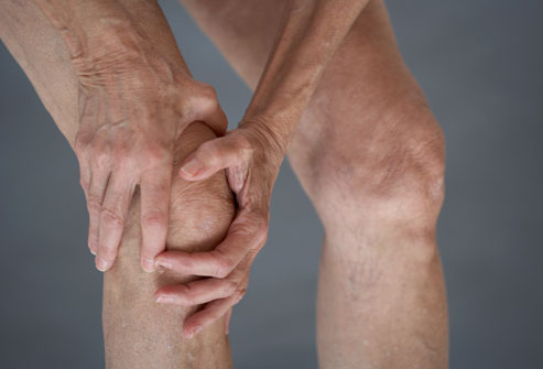 3.-Osteoarthritis