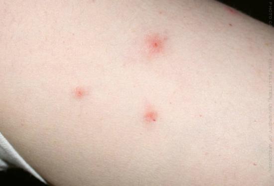 5.-Skin-Allergy
