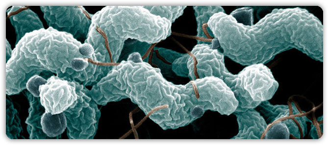 4.-Campylobacteriosis