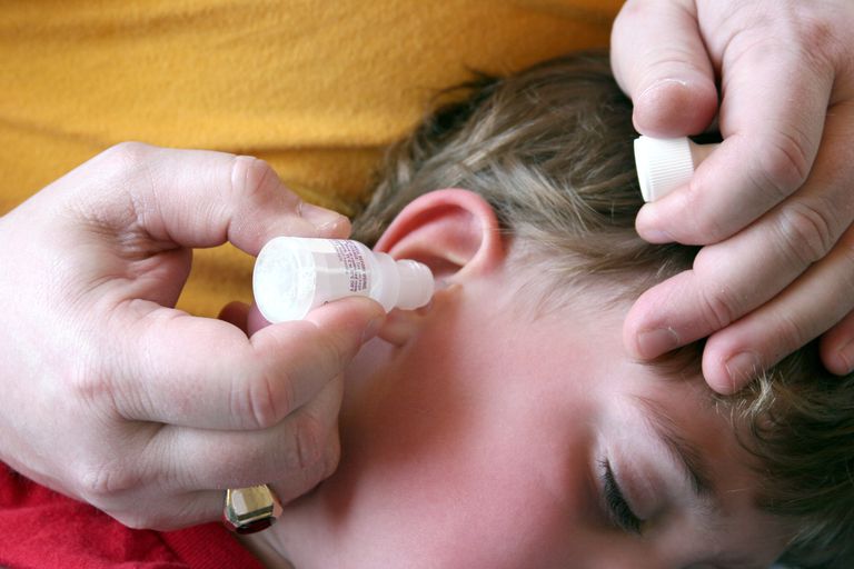 Otitis Externa (Swimmer’s Ear) Causes, Symptoms, Diagnosis & Treatment