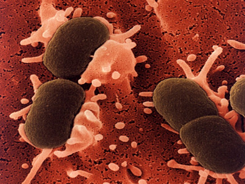 E. Coli Infections as related to Drinking Water - Pictures