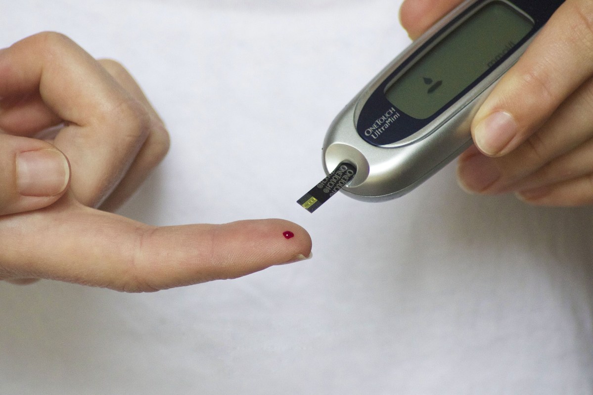 How-Diabetes-Mellitus-Type-2-Is-Diagnosed