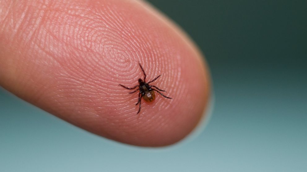 Lyme Disease Symptoms Prevention Diagnosis And Treatment