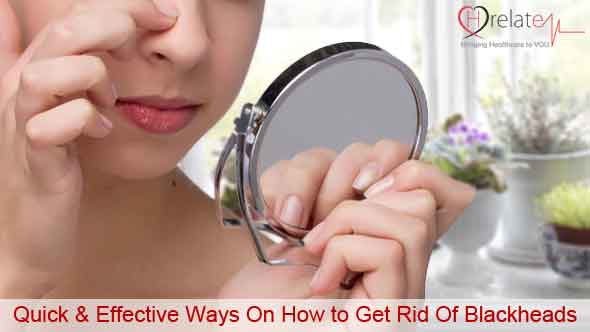 Quick & Effective Ways On How to Get Rid Of Blackheads