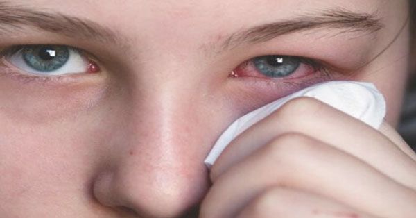 How to Know If Your Red, Itchy Eyes Are Because of Allergy or Infection?